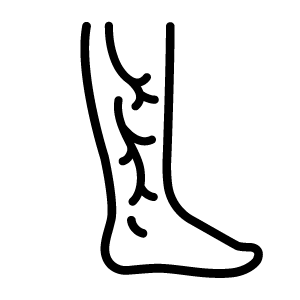 leg with veins icon
