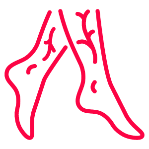 legs with veins icon