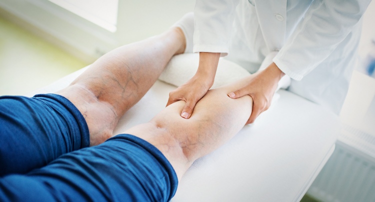 Advanced vein treatment can relieve leg pain and boost confidence
