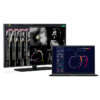 Coronary CT Angiogram | CardioNow