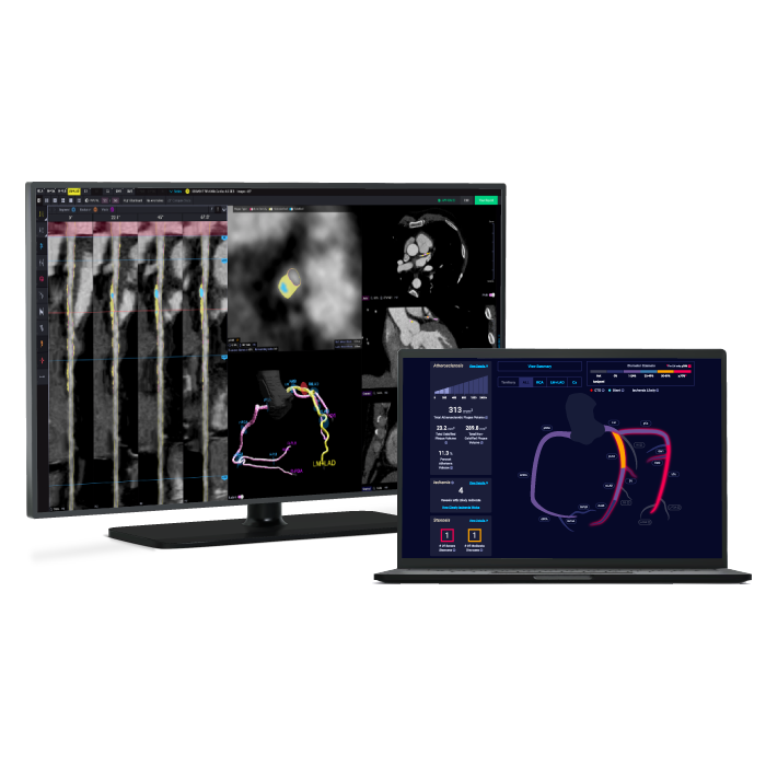 coronary calcium ct scan cleerly cad solution product