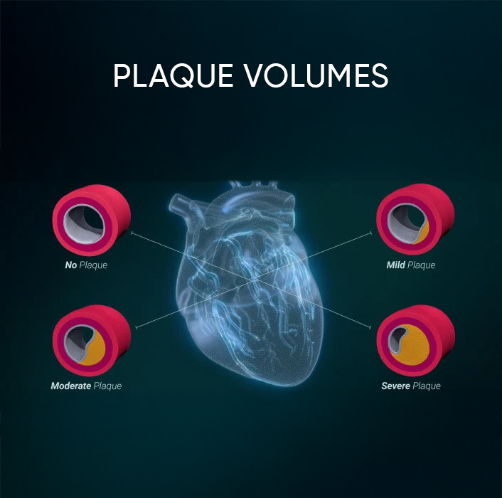 CCTA scan for plaque volume