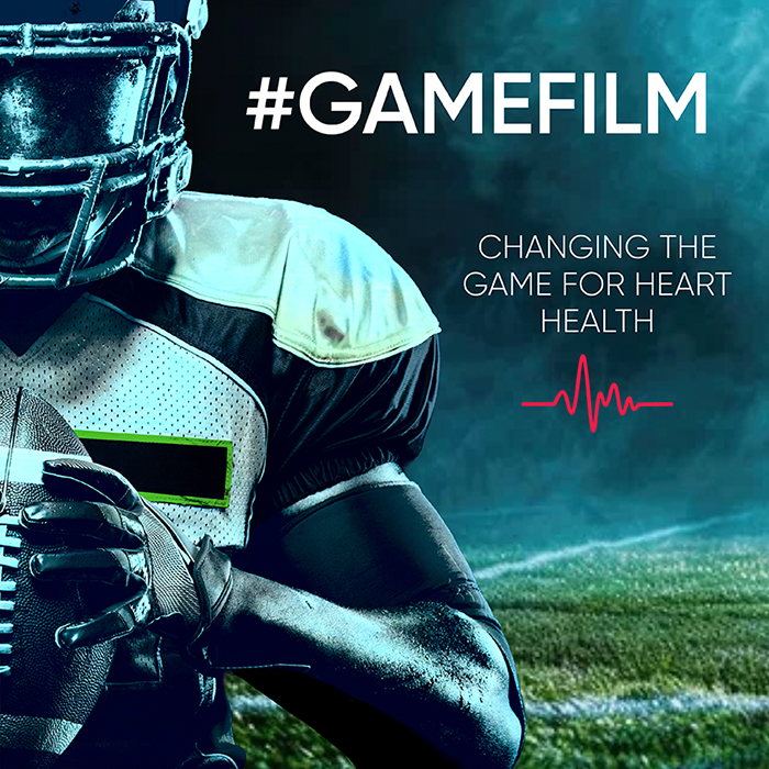 Research Study GAMEFILM NFL Alumni