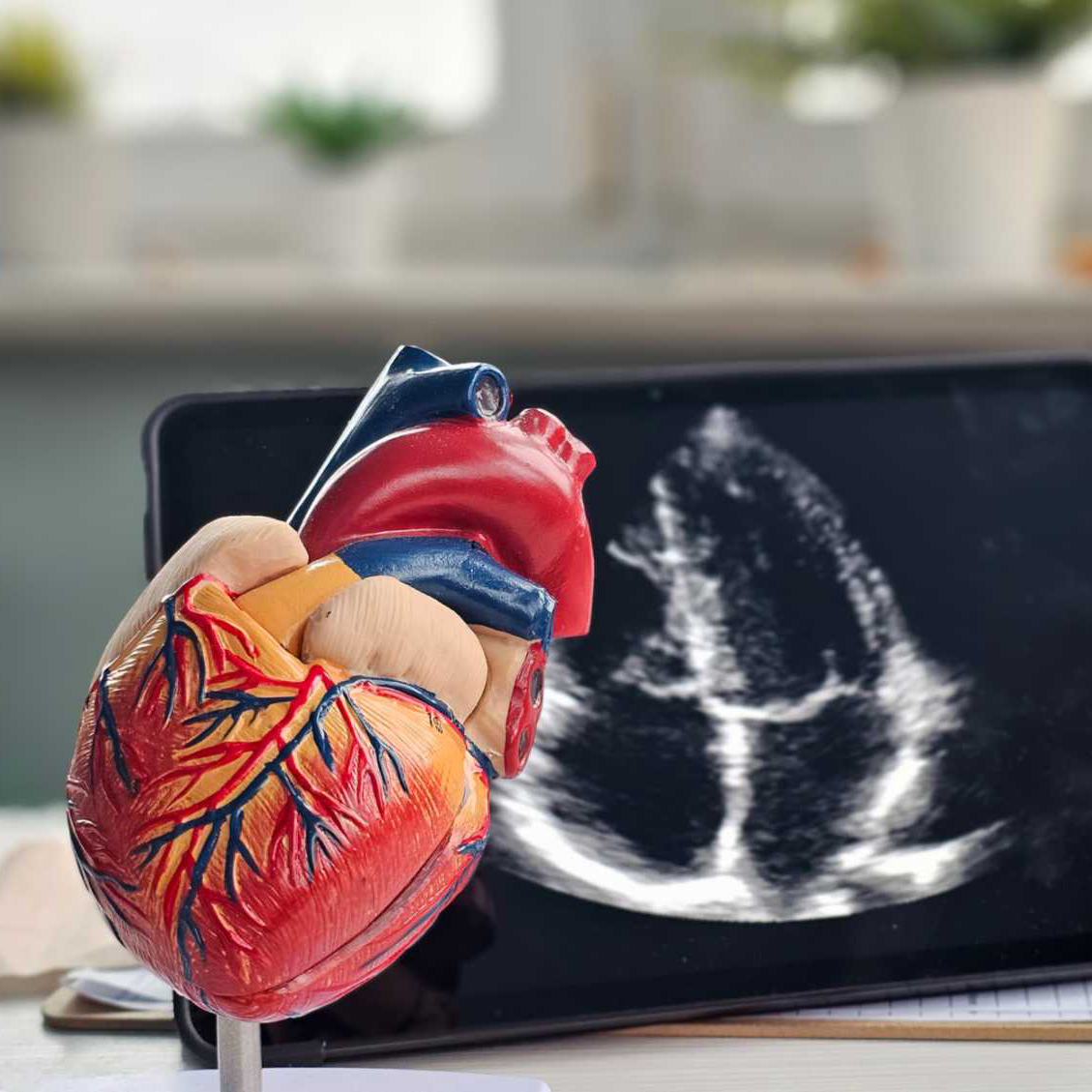 heart test echocardiogram report